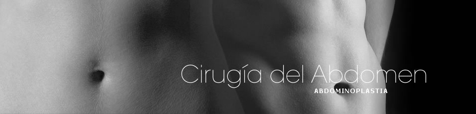 Cirugía estética del abdomen o abdominoplastia